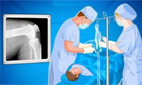 Operate Now: Knie-operatie
