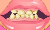 Transformação dos Dentes da Menina