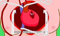 Heart Surgery