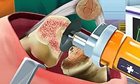 Knieoperation-Simulation